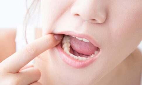 矯正で奥歯痛い原因と対処法 痛みの期間はどれくらい？