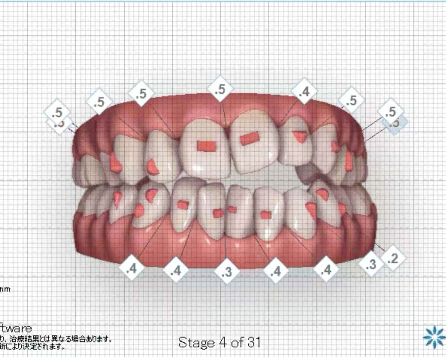 港区三田の審美歯科ピュアリオ歯科の検査機器3