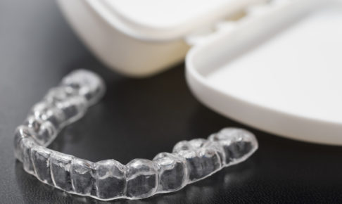 マウスピース矯正「インビザライン」 インビザラインによる歯科矯正の特徴とは？