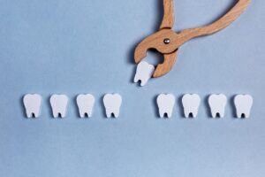 インビザラインは抜歯矯正もできる？抜歯が必要な症例と不要な症例やメリット・デメリットについて解説