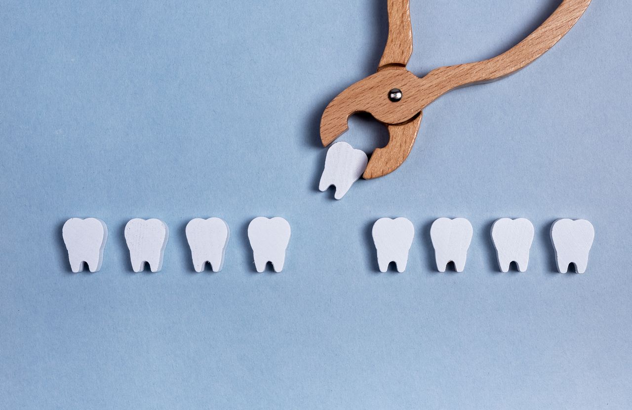 インビザラインは抜歯矯正もできる？抜歯が必要な症例と不要な症例やメリット・デメリットについて解説