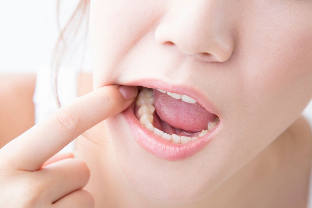 矯正で奥歯痛い原因と対処法 痛みの期間はどれくらい？