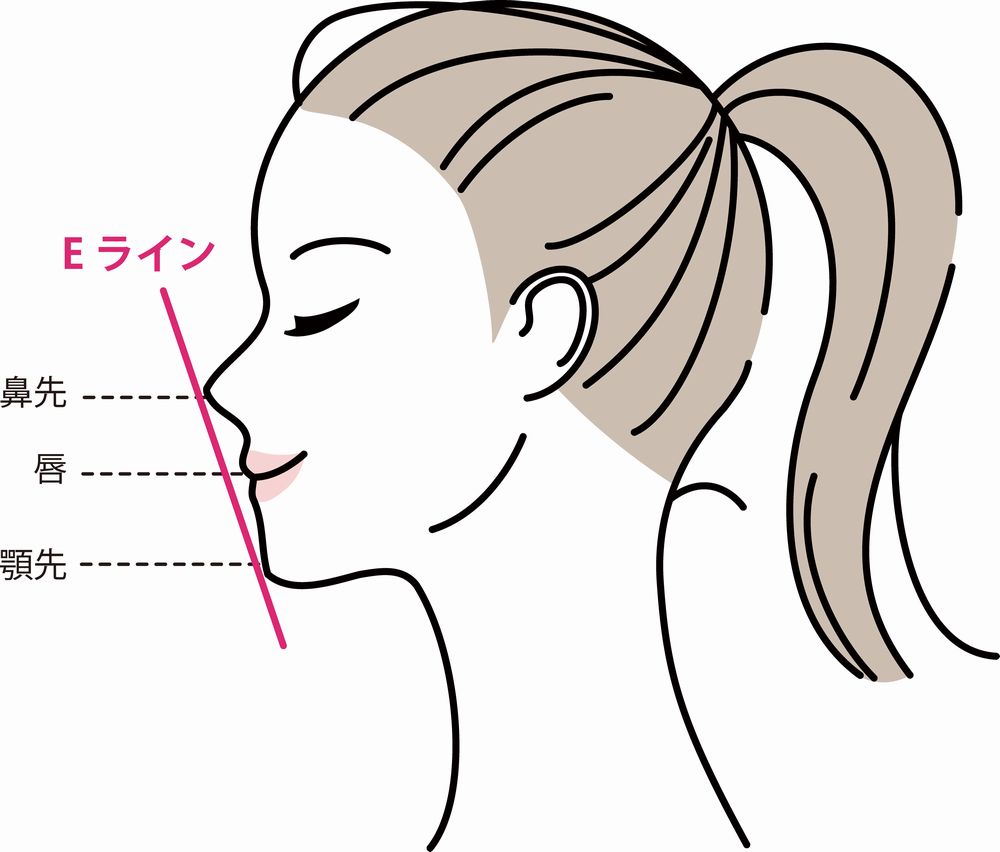口ゴボ矯正でほうれい線が目立つ？理由と歯列矯正による改善方法