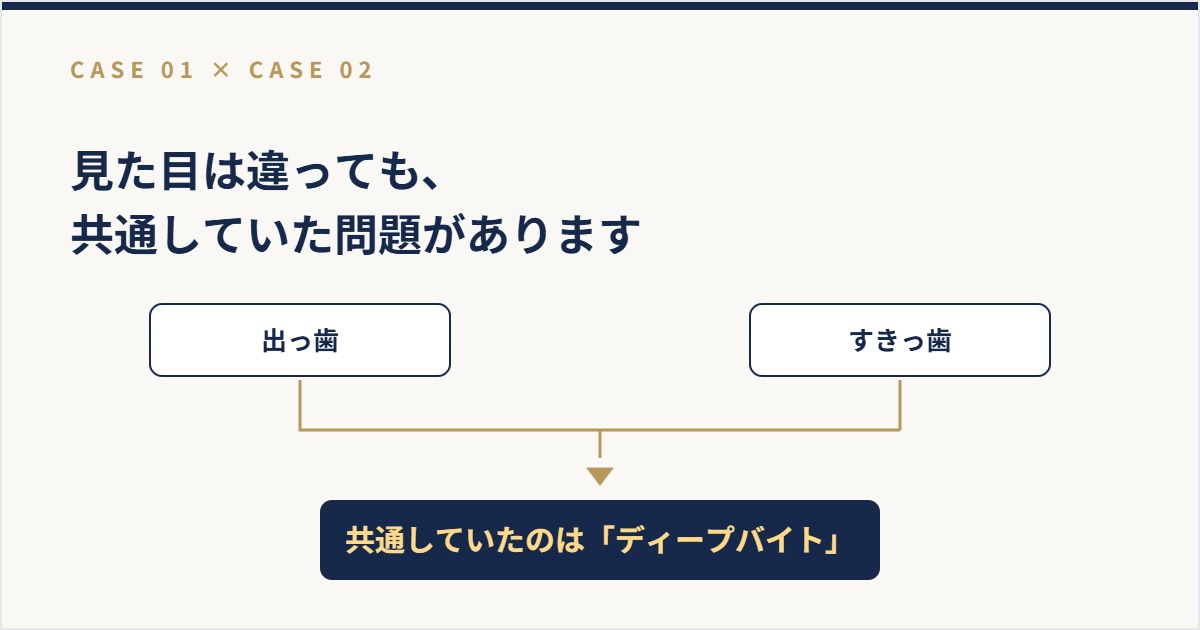 出っ歯とすきっ歯に共通するディープバイトを示した図解