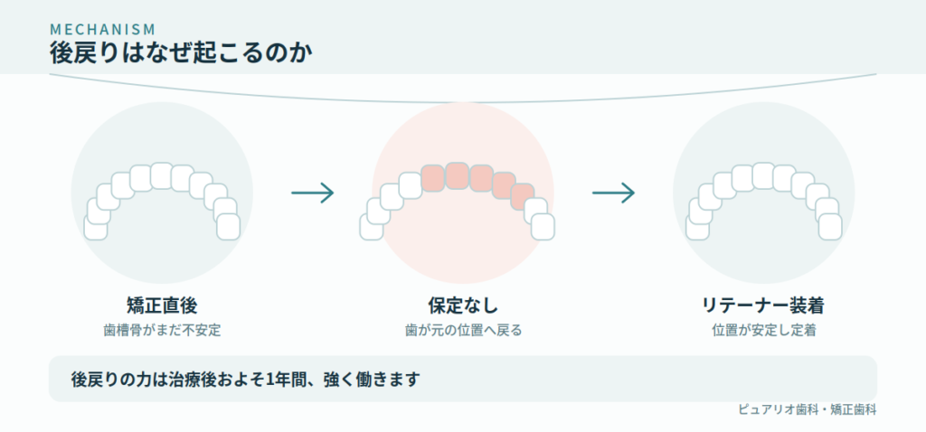 後戻りはなぜ起こるのか?