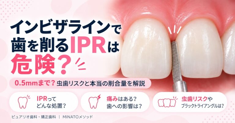 インビザラインで歯を削るIPRは危険?