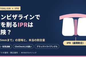 インビザラインで歯を削るIPRは危険？「0.5mmまで」の意味と本当の削合量