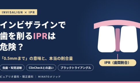 インビザラインで歯を削るIPRは危険？「0.5mmまで」の意味と本当の削合量