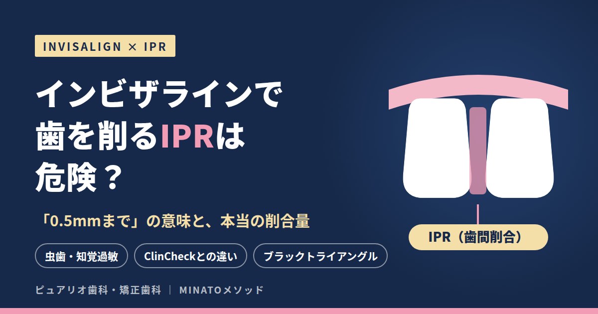 インビザラインで歯を削るIPRは危険?「0.5mmまで」の意味と本当の削合量