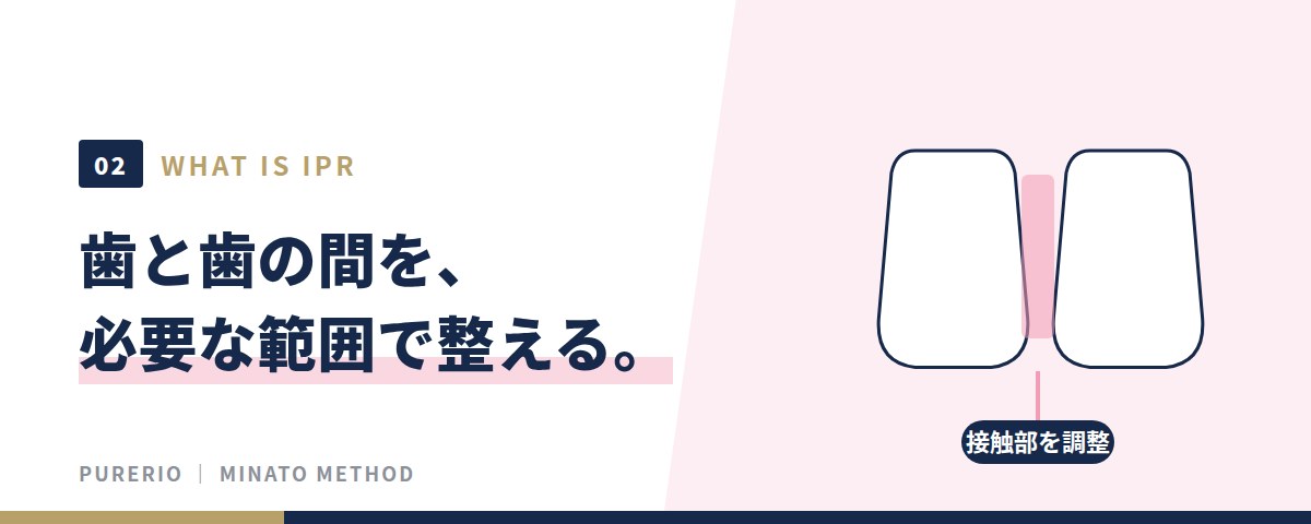 IPRとは、歯と歯の間を必要な範囲で整える処置