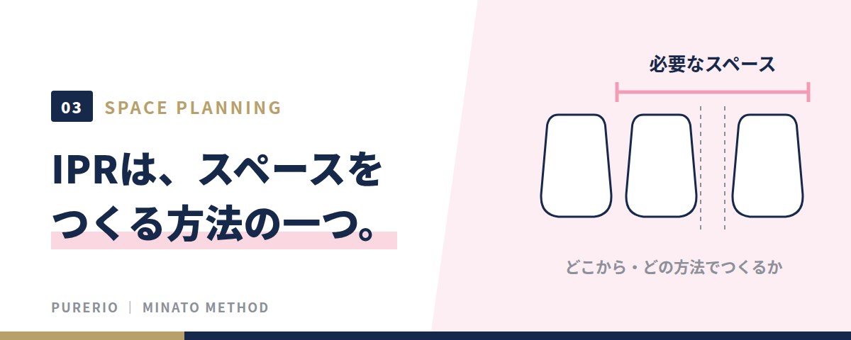 IPRはスペースをつくる方法の一つ